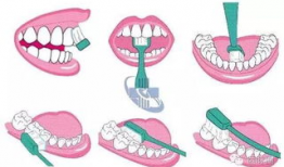 刷牙正确方法视频,守护口腔健康